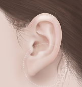 귓볽 필러 Before